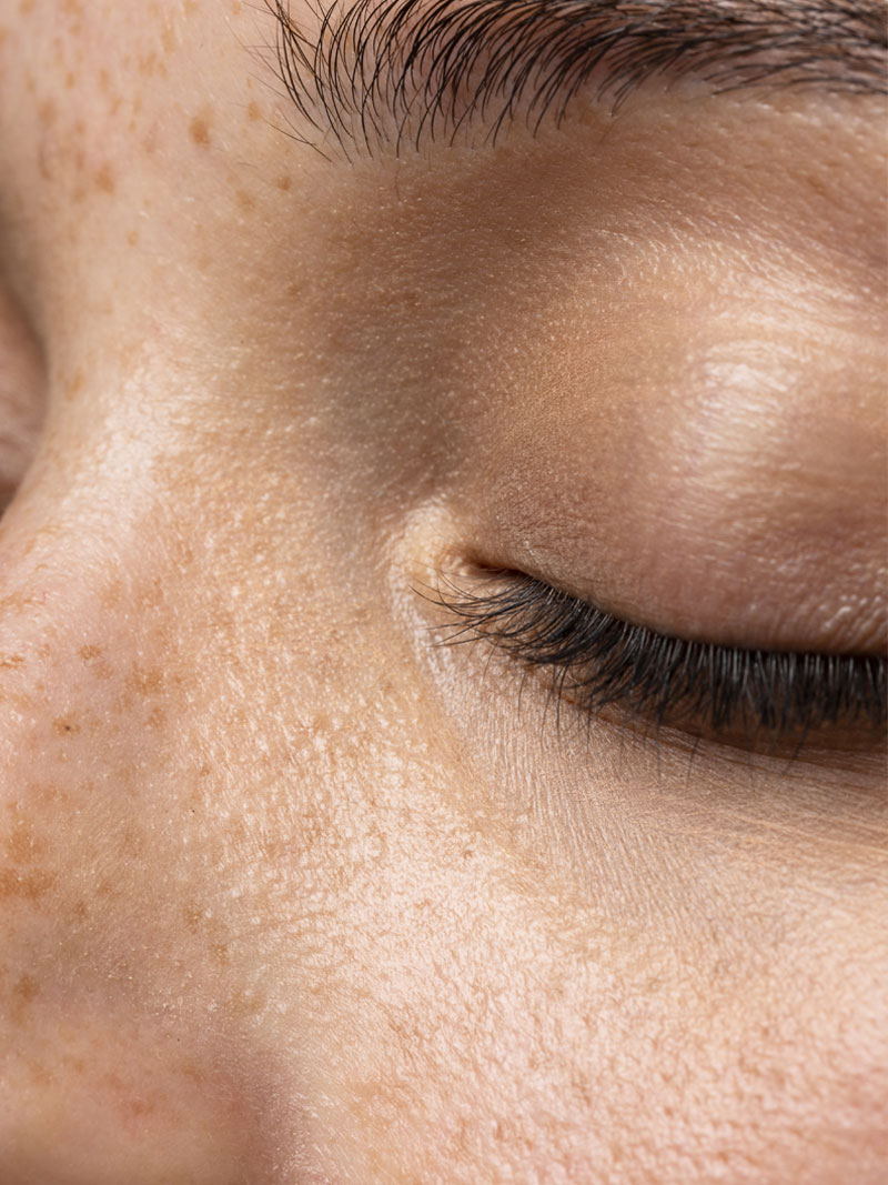 Jak zmniejszyć widoczność rozszerzonych porów?